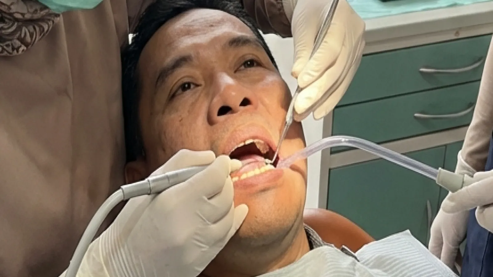 Pembersihan Karang Gigi