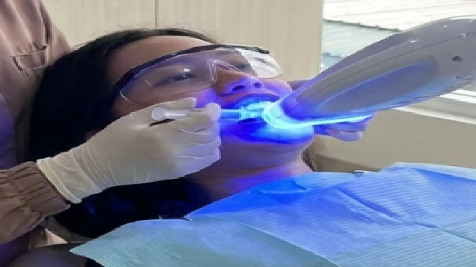 Teeth Whitening