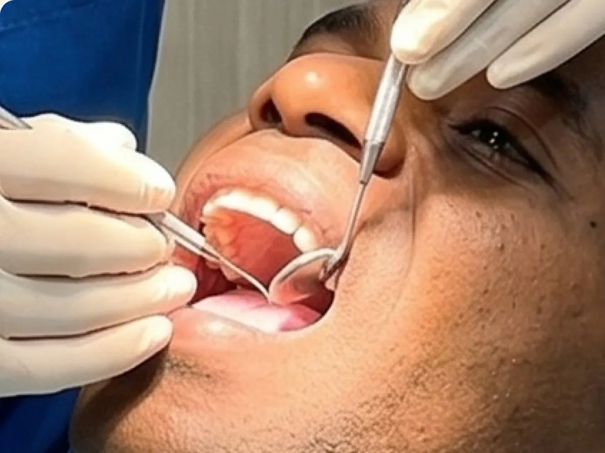 Pemeriksaan gigi rutin (dental check-up)